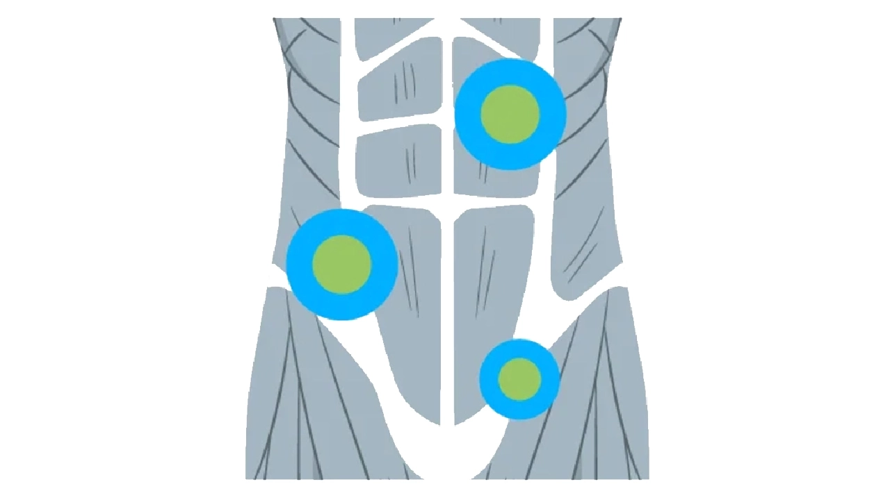 Abdominal and Retroperitoneal Sarcomas: Symptoms and Treatment